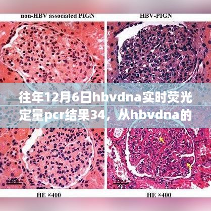 励志之旅，从HBV DNA定量PCR到人生无限可能——HBVDNA实时荧光定量PCR结果背后的故事