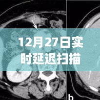 实时延迟扫描，揭秘12月27日数据延迟真相