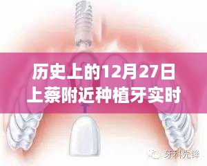 历史上的种植牙实时价格，上蔡地区12月27日回顾