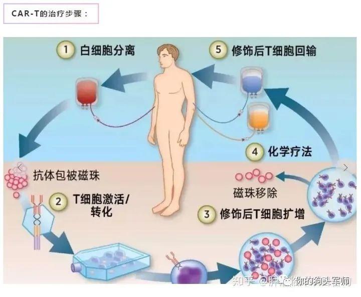 革命性癫痫治疗突破，全新科技产品上市，引领未来治疗方向