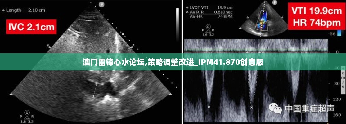 澳门雷锋心水论坛,策略调整改进_IPM41.870创意版